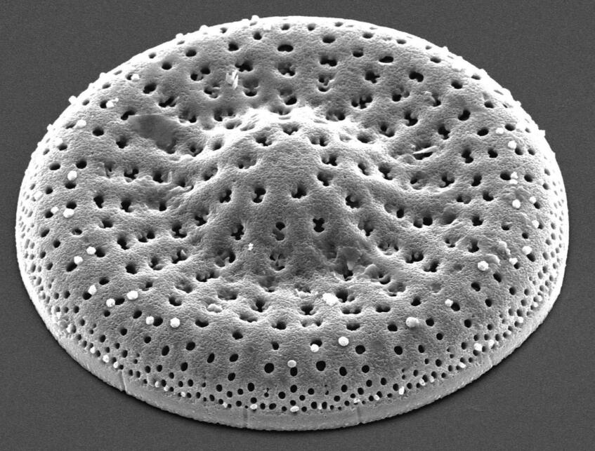化石珪藻Mesodictyon japonicum Yanagisawa & H.Tanaka の走査型電子顕微鏡写真